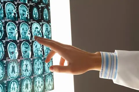 Doctor examining brain scans on lightbox. 